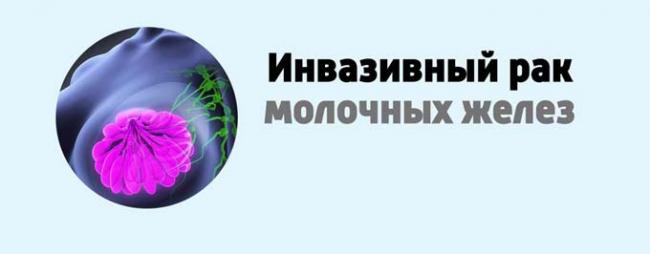 Инвазивный рак молочных желез