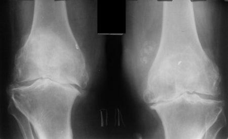 ris-1-gon-450x276.jpg