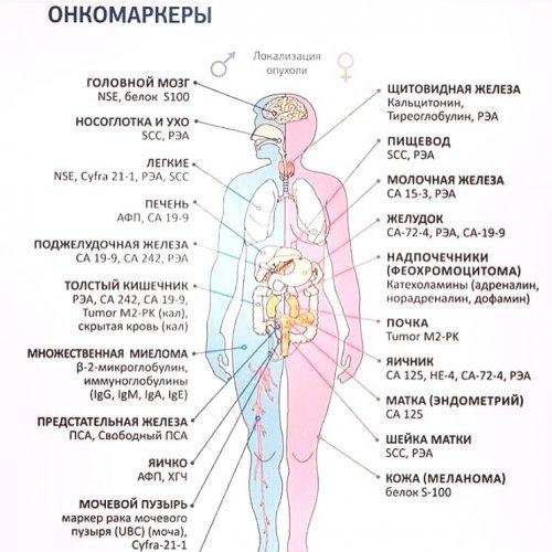 1567489629_kakie-byvayut-onkomarkery.jpg
