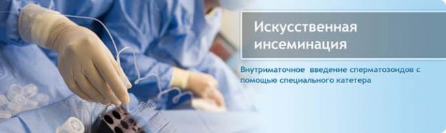 искусственная инсеминация