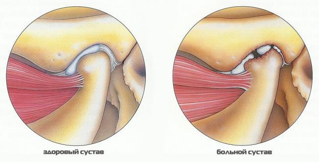 chelyustno_litsevogo_sustava_simptomy_lechenie.jpg