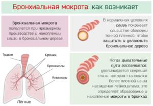 Prichiny-obrazovaniya-mokroty-300x207.png