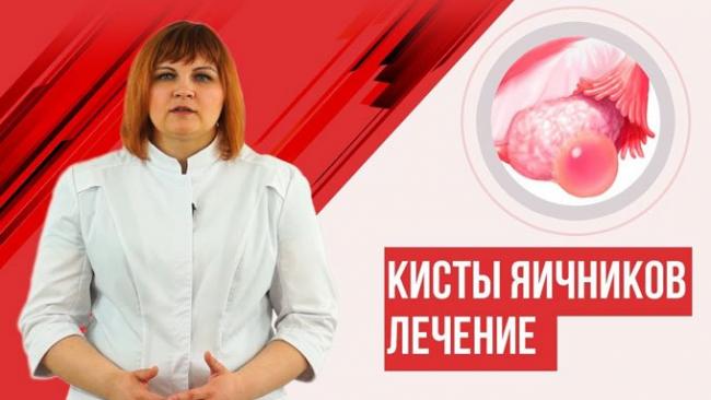 кисты яичников