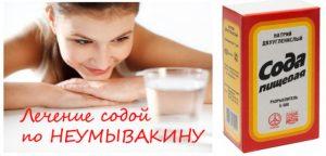 soda-po-neumyvakinu-300x144.jpg