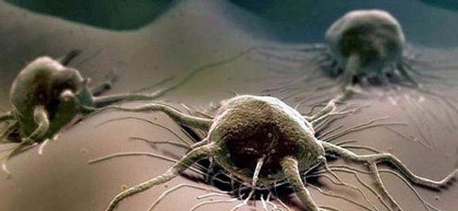 Лечение трихомониаза у женщин: препараты и народные методы