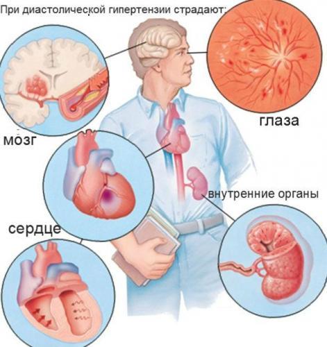 Органы-страдающие-при-диастолической-гипертензии.jpg