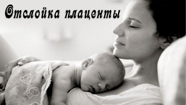 срок отслойки плаценты