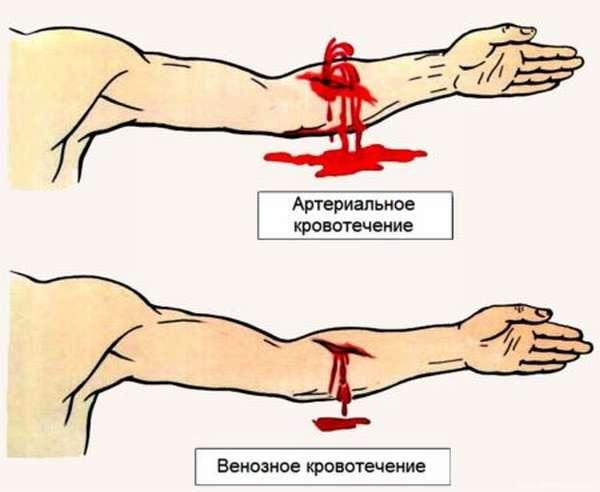 Какие обозначения имеют различные группы крови и резус-фактор в анализах, значение данных показателей