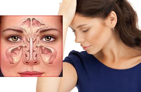 Simptomy-frontita-u-vzroslyh.jpg