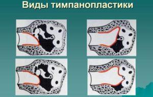eizm0rbv.jpg