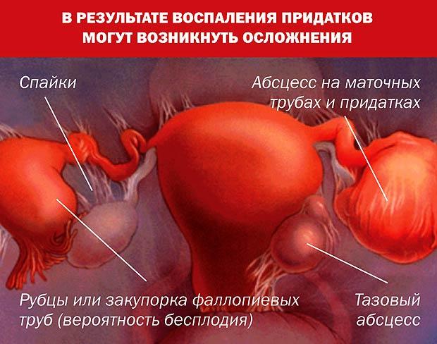 возможные осложнения
