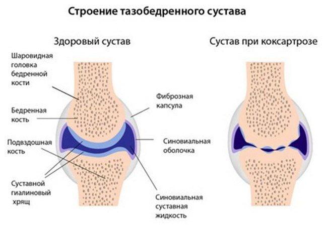 boli-v-tazobedrennom-sustave-nochyu.jpg