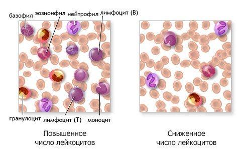 snizhennoe-chislo-lejkotsitov.jpg