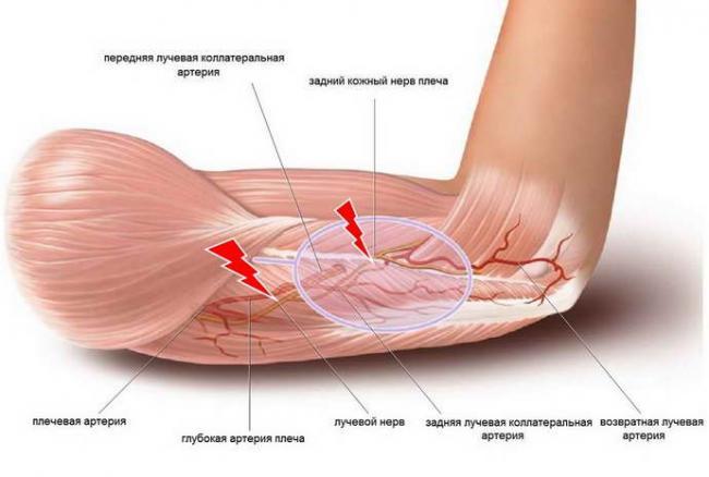 zashhemlenie-nerva-v-plechevom-sustave-simptomy-i-lechenie-11.jpg