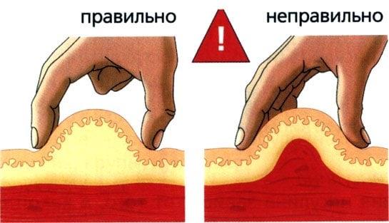 как колоть пурегон