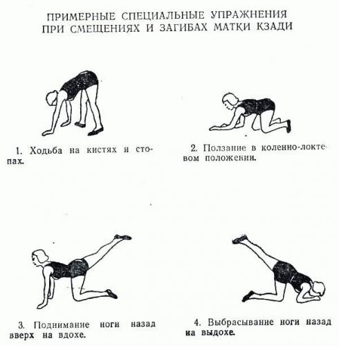 упражнения при загибе матки