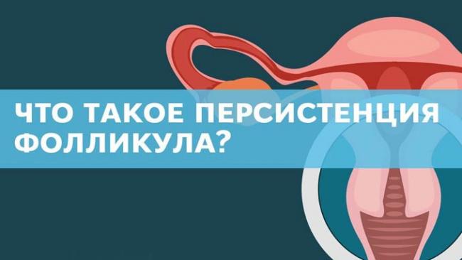 персистенция доминантного фолликула