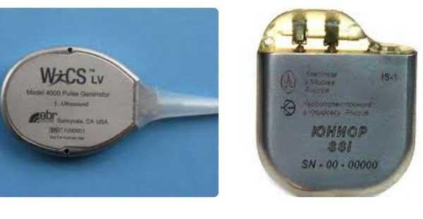 kardiostimulyator-serdca-3.jpg