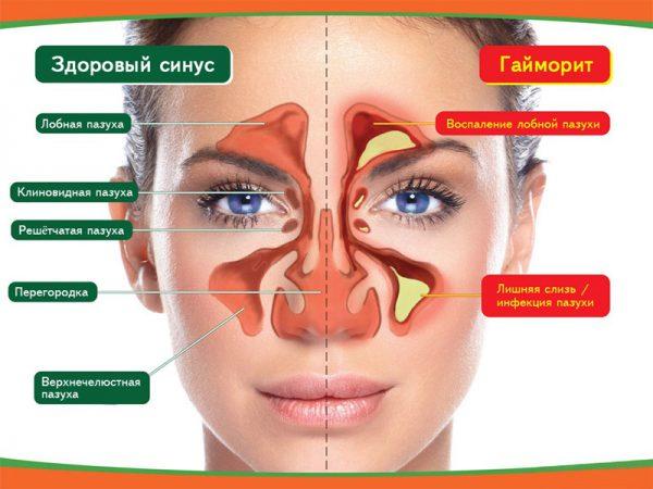 gaymorit-3-600x450.jpg