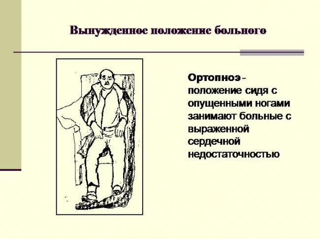 Ортопноэ.jpg