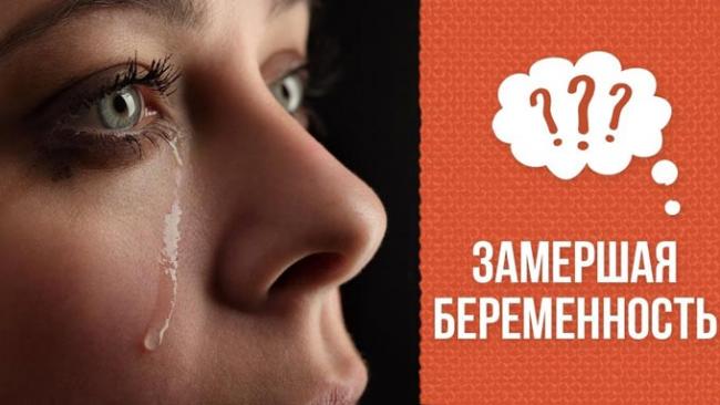 признаки замершей беременности