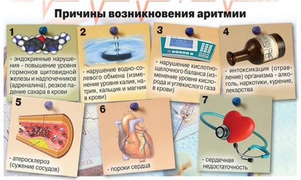 pristup-aritmii-kak-vosstanovit-ritm-serdtsa-v-domashnih-usloviyah-1.jpg