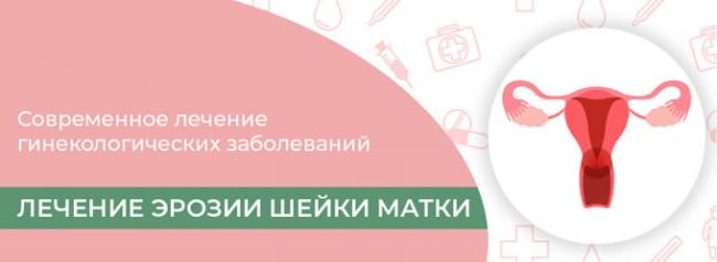 лечение эрозии шейки матки