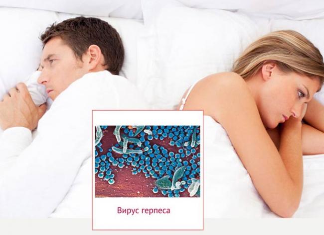вирус герпеса