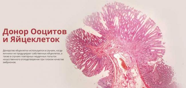 что такое донор ооцитов