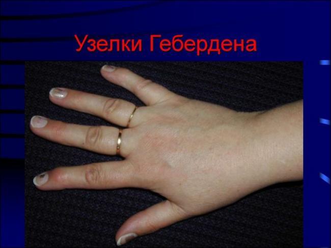 prichiny_poyavleniya_shishek.jpg