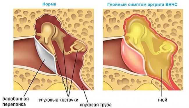 Artrit-chelyusti-simptomy-i-lechenie.jpg