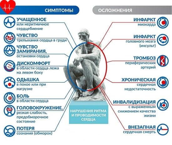 simptomu_aritmii_kardiodok_q311-min.jpg